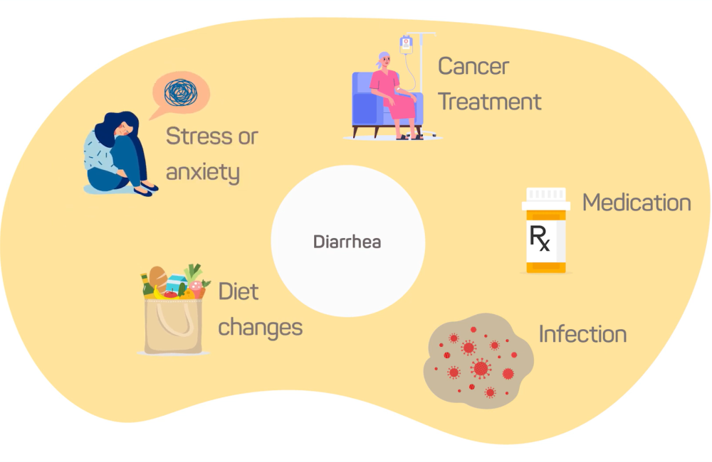 Diarrhea: During and After Cancer Treatment